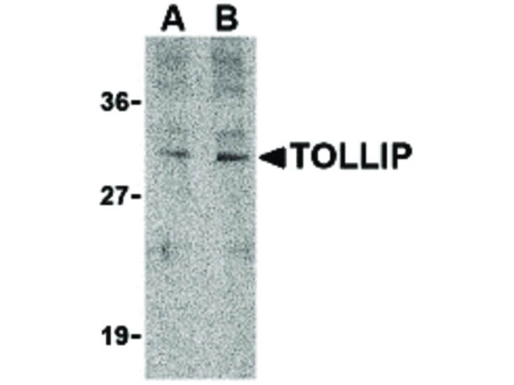 Western Blot of TOLLIP Antibody