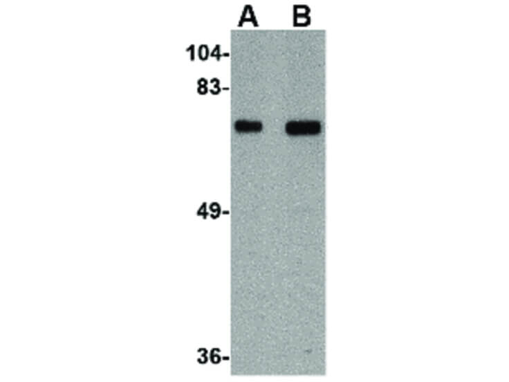 Western Blot of TOM70 Antibody