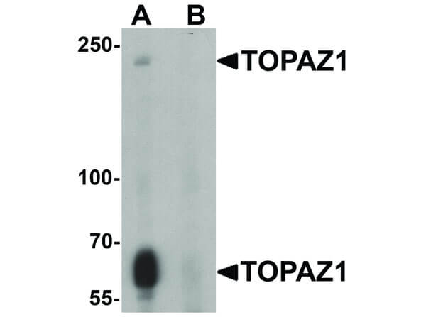 Western Blot of TOPAZ1 Antibody