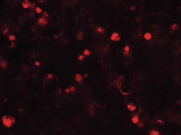 Immunofluorescence of TOPAZ1 Antibody