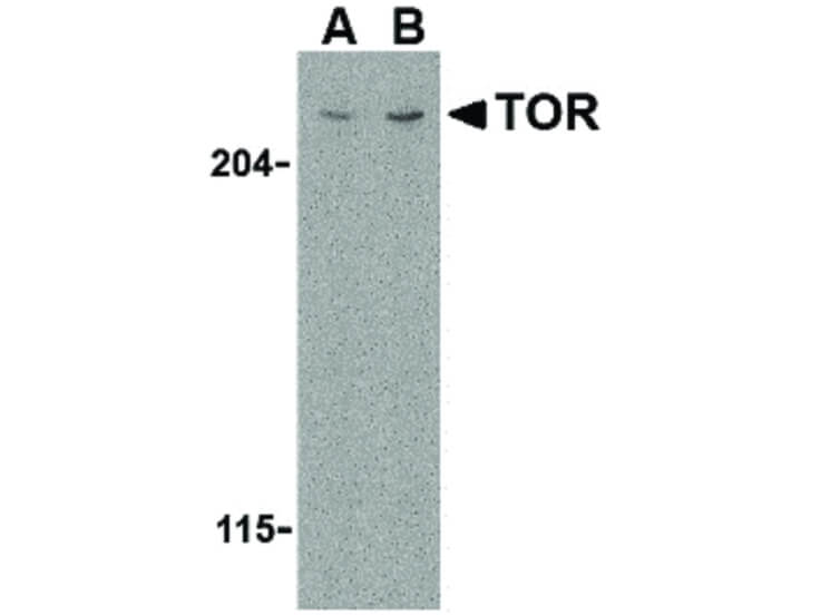 Western Blot of TOR Antibody