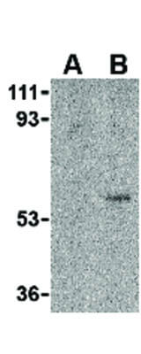 Western Blot of Toso Antibody
