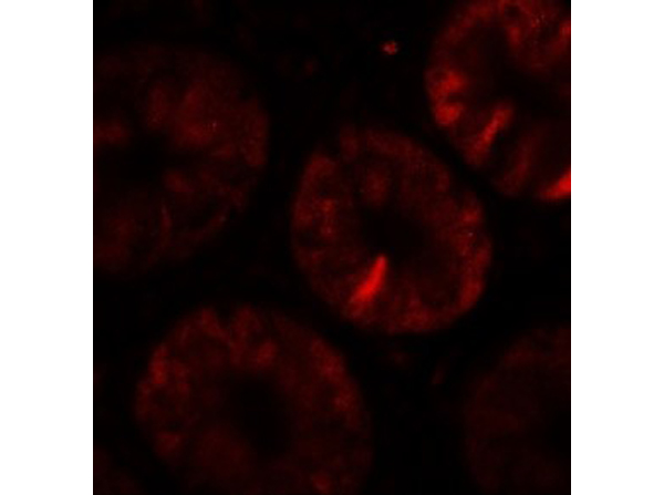 Immunofluorescence of TOX