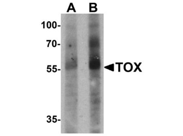 Western blot analysis of TOX