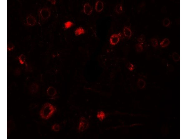 Immunofluorescence of TPT1