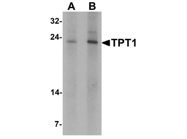 Western blot analysis of TPT1