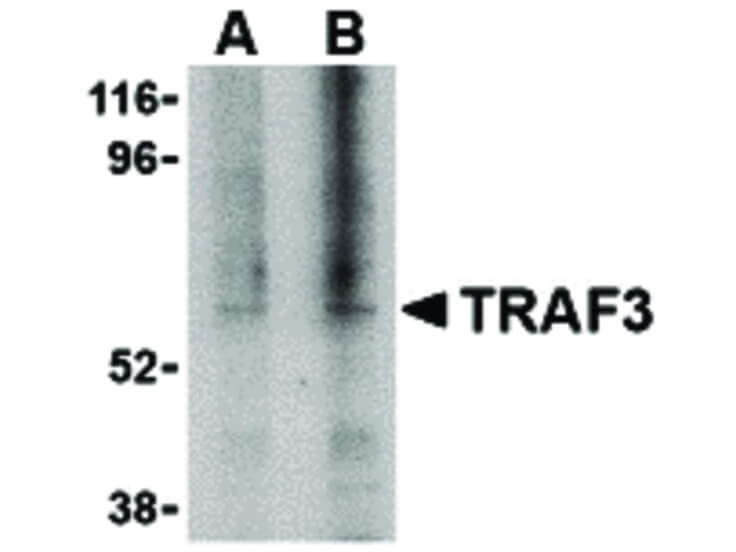 Western Blot of TRAF3 Antibody