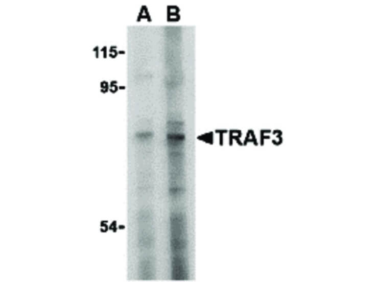 Western Blot of TRAF3 Antibody