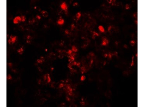 Immunofluorescence of Translin