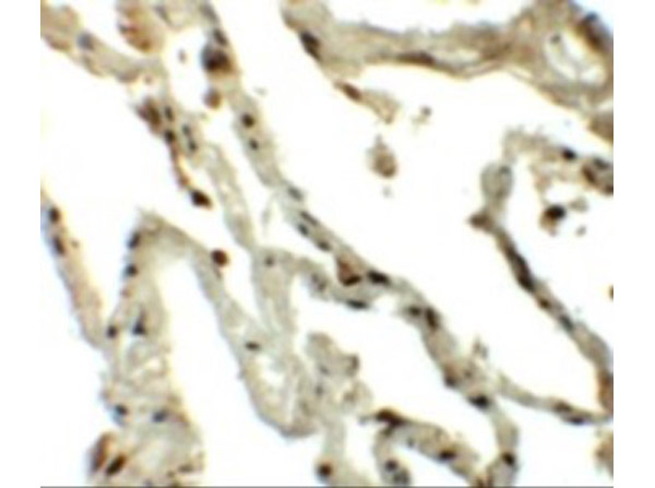 Immunohistochemistry of Translin