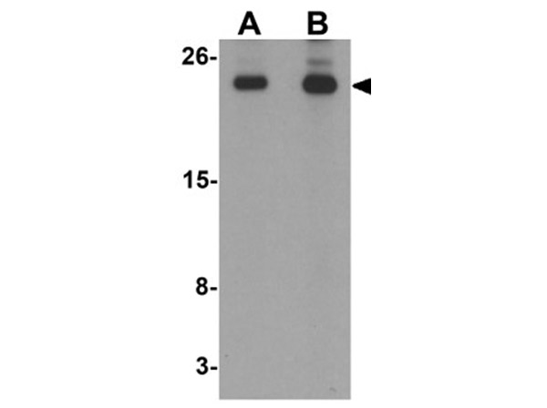 Western blot analysis of Translin.