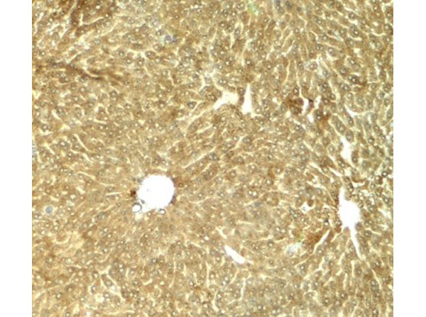 Immunohistochemistry of TRB3