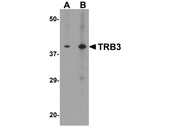 Western blot of TRB3