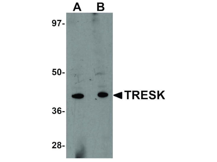 Western Blot of TRESK Antibody