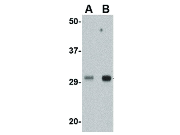 Western Blot of TREX1 Antibody