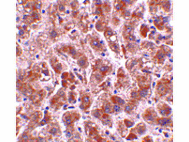 Immunohistochemistry of TREX2 Antibody