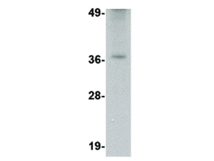 Western Blot of TREX2 Antibody