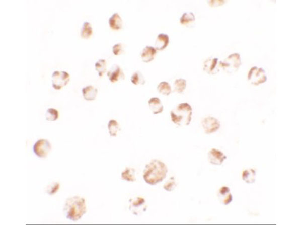 Immunocytochemistry of TRIM24