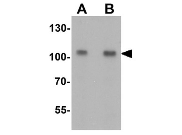 Western blot of TRIM24