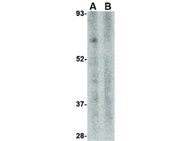 Western Blot of TRIM25 Antibody