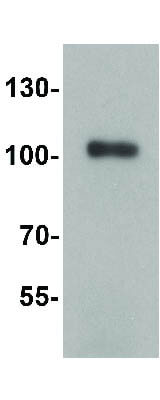 Western Blot of TRIM28 Antibody