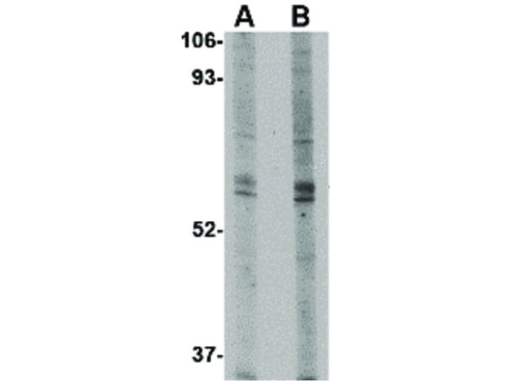 Western Blot of TRIM30 Antibody
