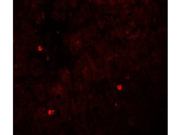 Immunofluorescence of TRIM33