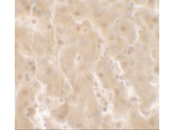 Immunohistochemistry of TRIM33