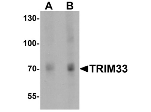 Western blot of TRIM33