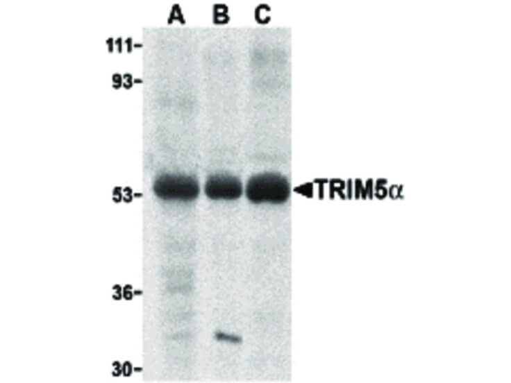 Western Blot of TRIM5 alpha Antibody