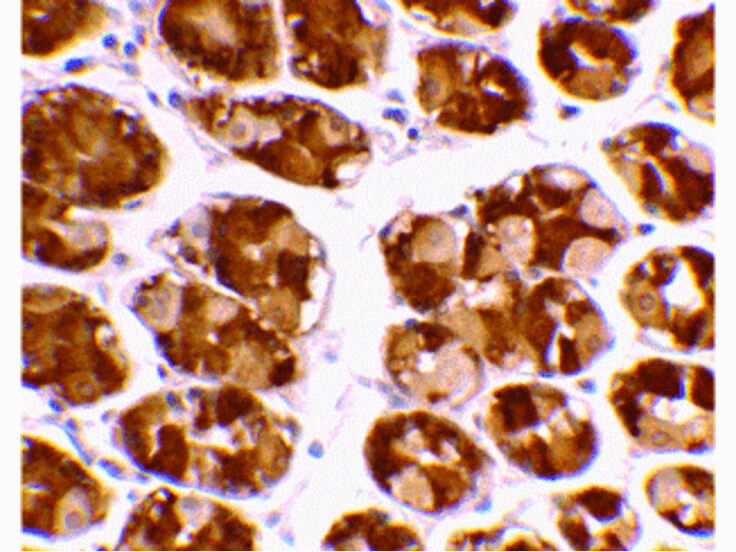 Immunohistochemistry of TRIM5 alpha Antibody