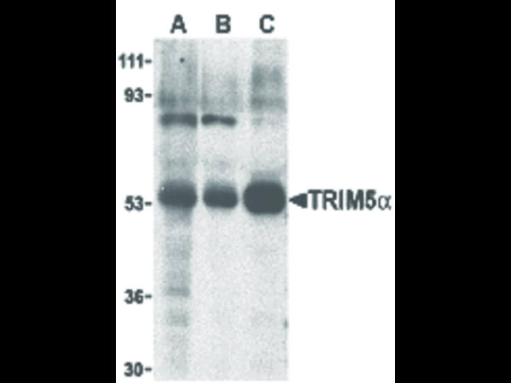 Western Blot of TRIM5 alpha Antibody