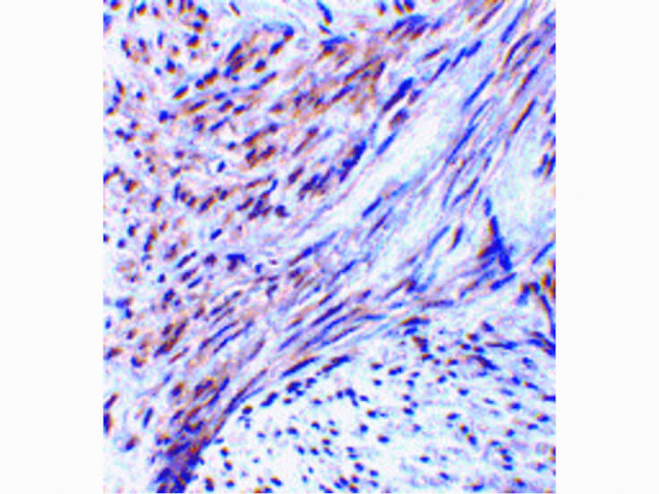 Immunohistochemistry of TRIM5 alpha Antibody