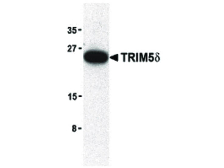 Western Blot of TRIM5 delta Antibody