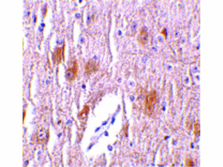 Immunohistochemistry of TRIM5 delta Antibody