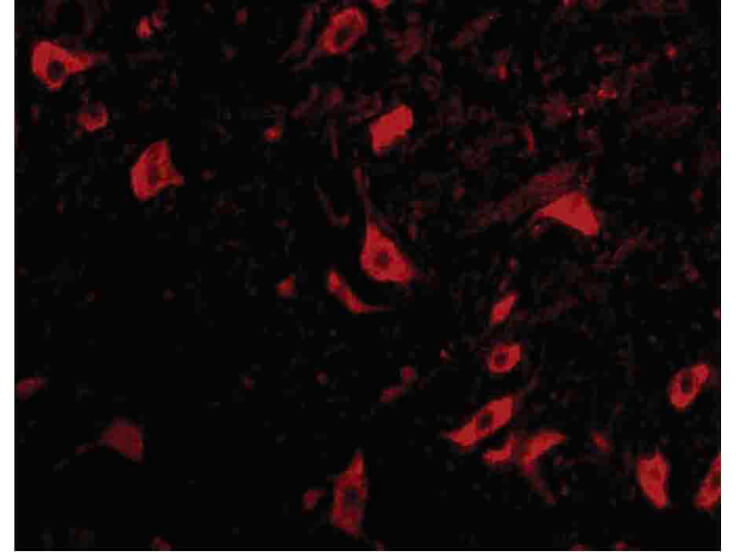 Immunofluorescence of TRIM5 delta Antibody