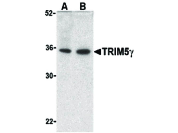 Western Blot of TRIM5 gamma Antibody