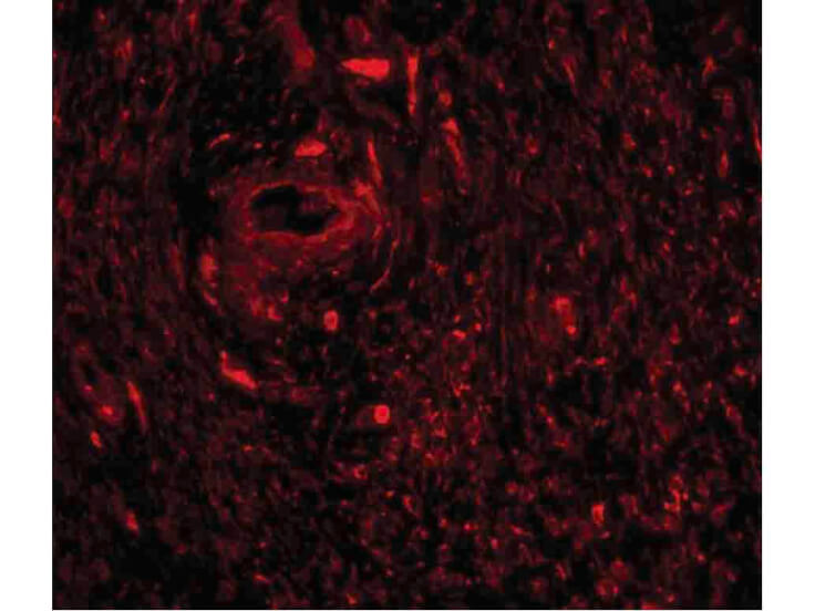 Immunofluorescence of TRIM5 gamma Antibody