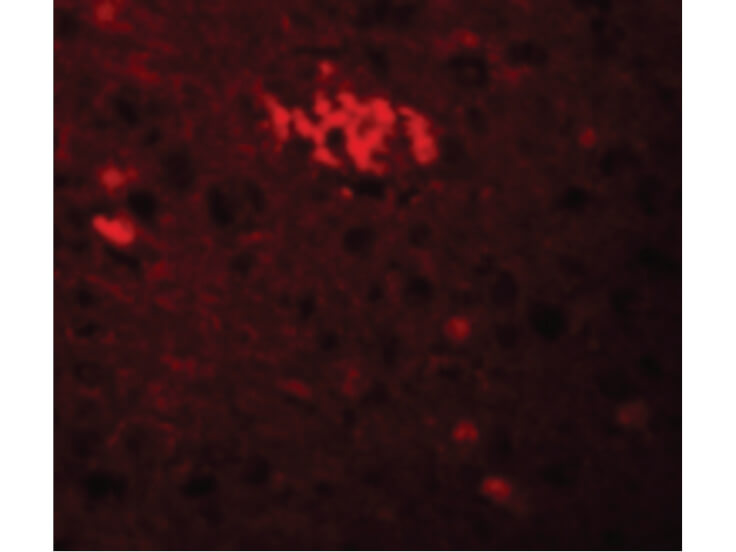 Immunofluorescence of TRIM71 Antibody