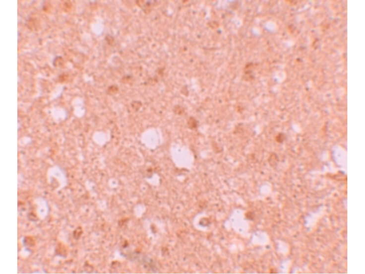 Immunohistochemistry of TRIM71 Antibody