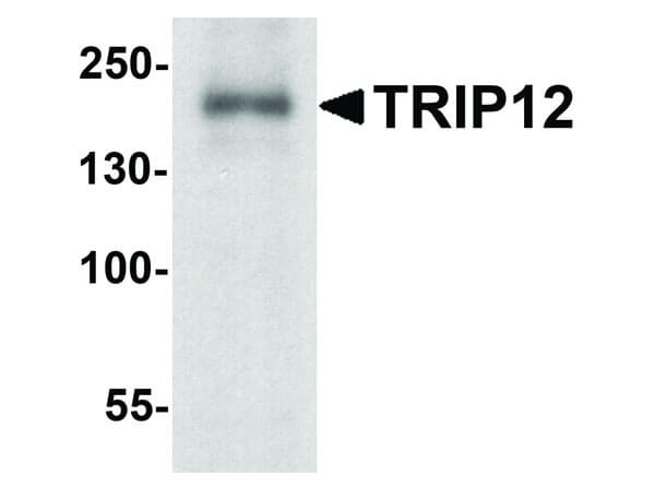 Western Blot of TRIP12 Antibody