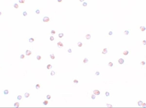 Immunocytochemistry of TRIP6