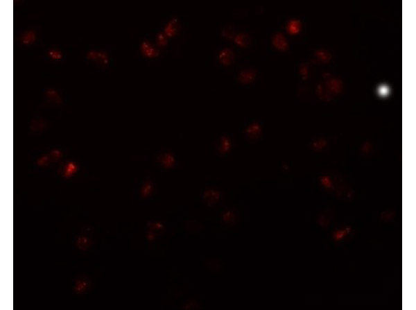 Immunofluorescence of TRIP6