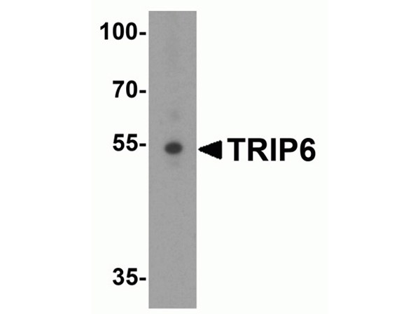 Western blot of TRIP6