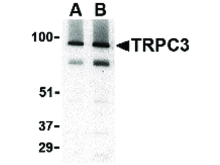 Western Blot of TRPC3 Antibody
