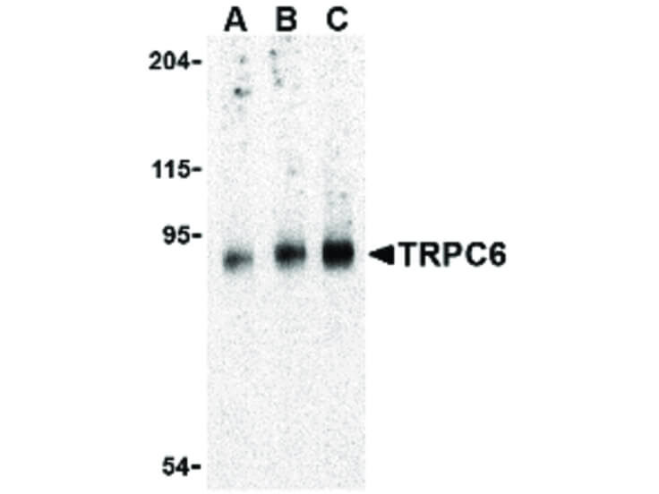Western Blot of TRPC6 Antibody