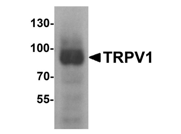Western blot analysis of TRPV1