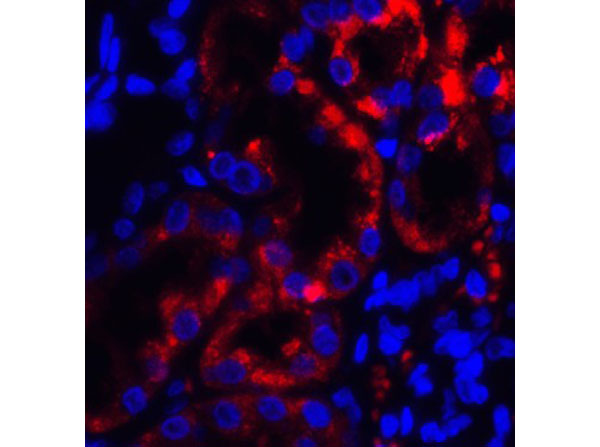 Immunofluorescence of TRPV4