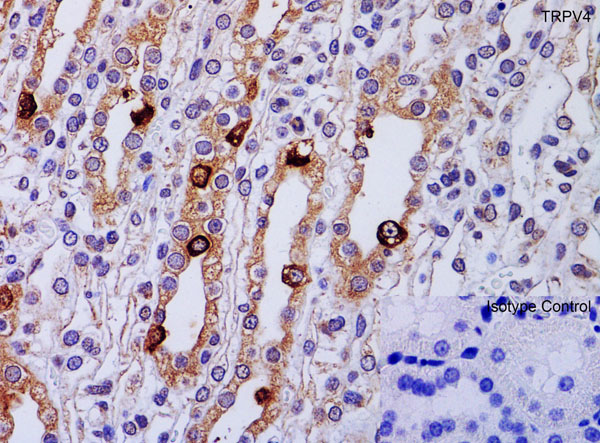Immunohistochemistry of TRPV4