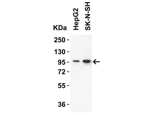 Western Blot of TRPV4